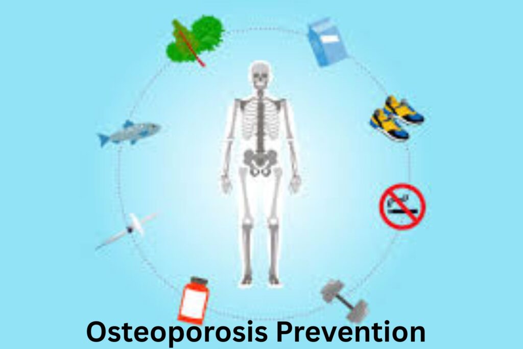 Osteoporosis Prevention